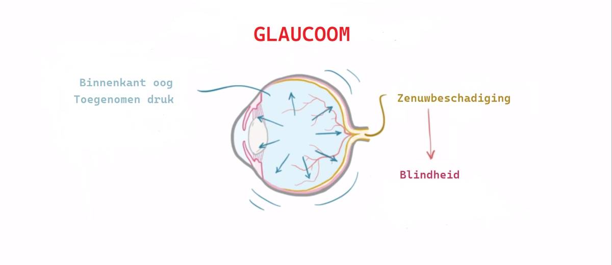 Glaucoom, groene staar, verhoogde oogdruk bij een Samojeed